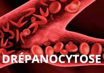 Protocole national de prise en charge de la drépanocytose en Rd Congo